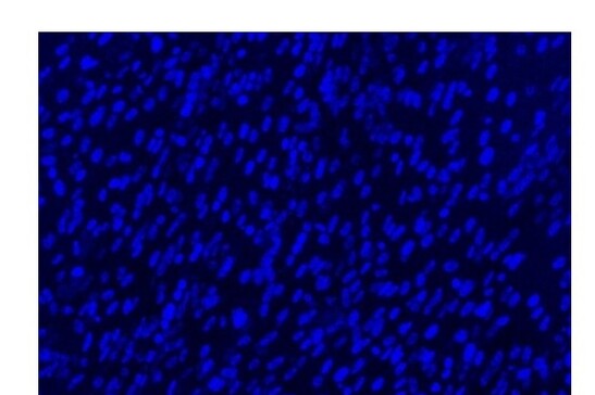 Ingrandimento con microscopio a fluorescenza dei nuclei delle cellule muscolo scheletriche (fonte: Istituto Italiano di Tecnologia - © IIT, all rights reserved)