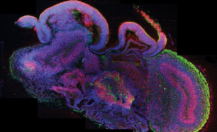 Un organoide cerebrale  (fonte: IMBA/Lancaster via Wikipedia) © Ansa