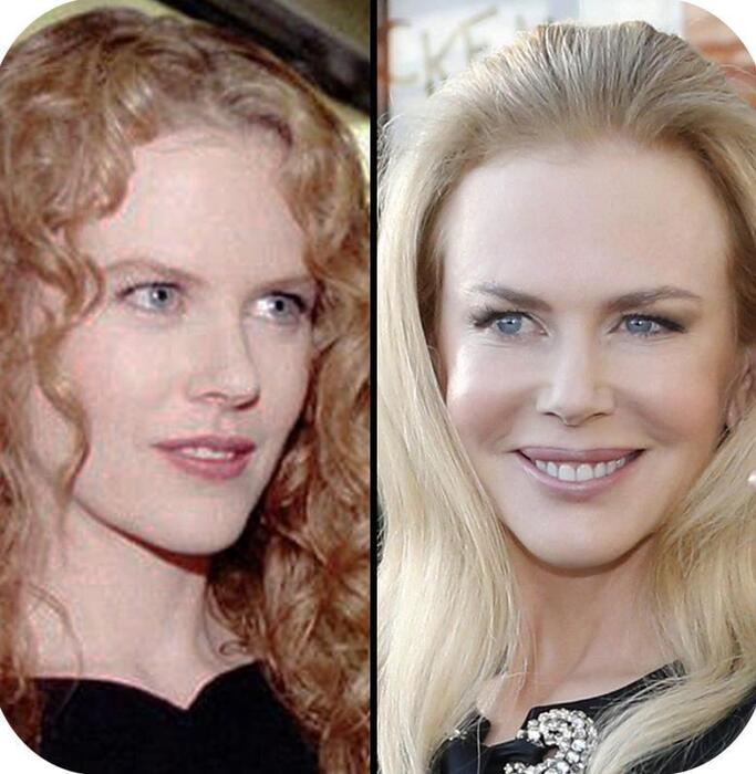 Nicole Kidman nel 1996 e ieri a Cannes © Ansa