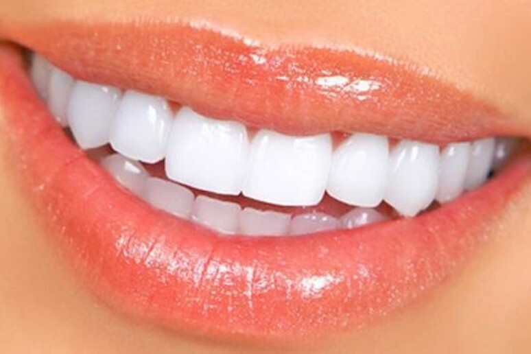 La salute dei denti può predire il rischio diabete - RIPRODUZIONE RISERVATA