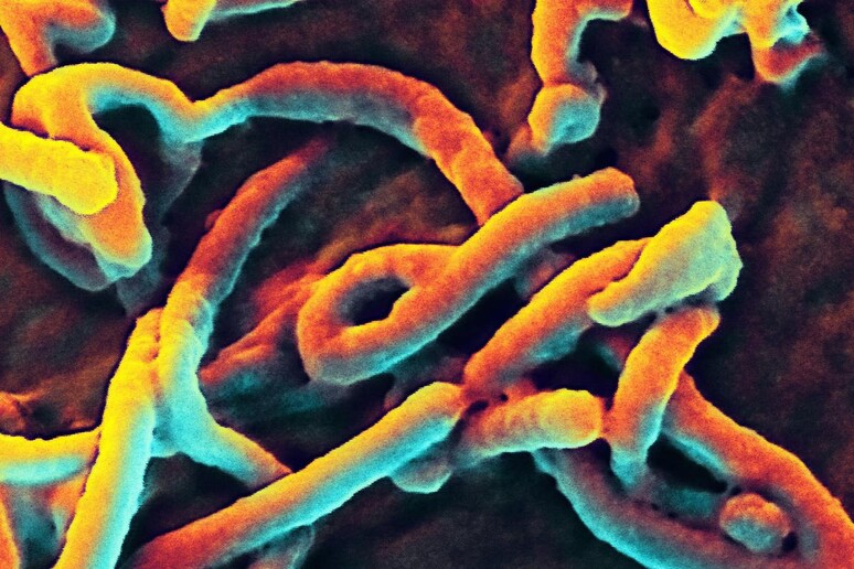 Il virus di Ebola al microscopio elettronico © ANSA/EPA