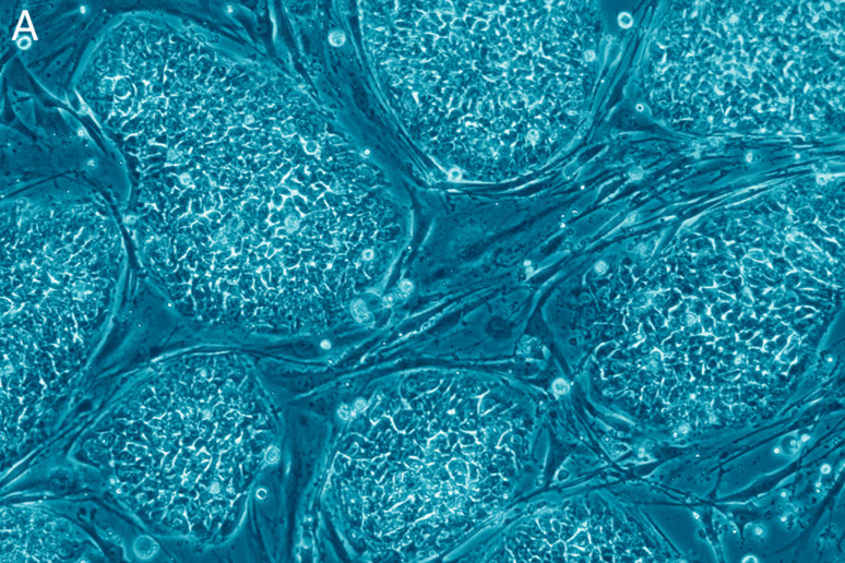 Cellule staminali (fonte: Nissim Benvenisty) - RIPRODUZIONE RISERVATA