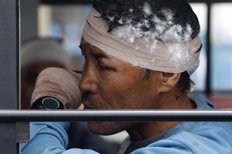 REPORTAGE tra i feriti a Kathmandu © ANSA/AP