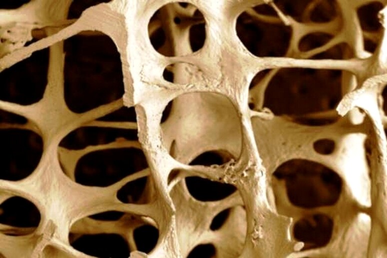 Osteoporosi, algoritmo Aifa predice rischio frattura - RIPRODUZIONE RISERVATA