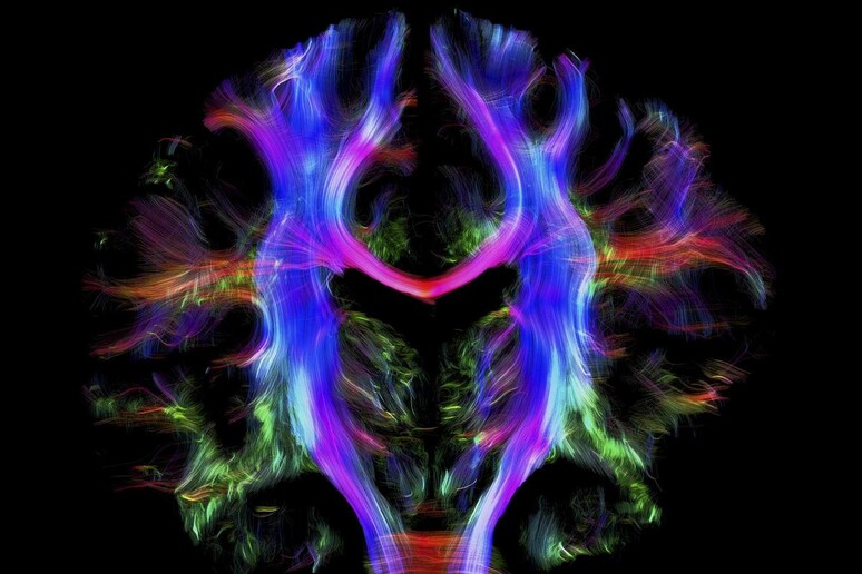 Connessioni neurali nel cervello umano (fonte: Alfred Anwander, Max Planck Institute for Human Cognitive and Brain Sciences - Wellcome Images Awards 2016) - RIPRODUZIONE RISERVATA