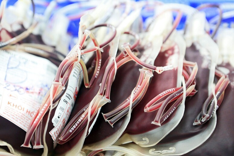 Carenze sangue in quattro regioni, mancano 800 sacche - RIPRODUZIONE RISERVATA