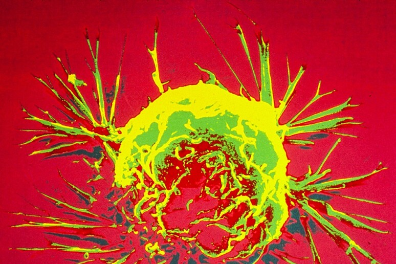 Una cellula del tumore del seno (fonte: Bruce Wetzel e Harry Schaefer, NCI-NIH) - RIPRODUZIONE RISERVATA