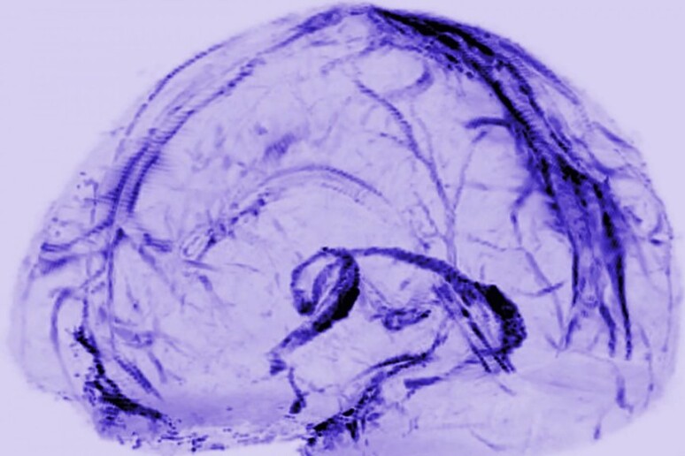 Rappresentazione grafica del sistema con cui il cervello drena le sostanze di scarto (fonte:  Reich Lab, NIH/NINDS) - RIPRODUZIONE RISERVATA