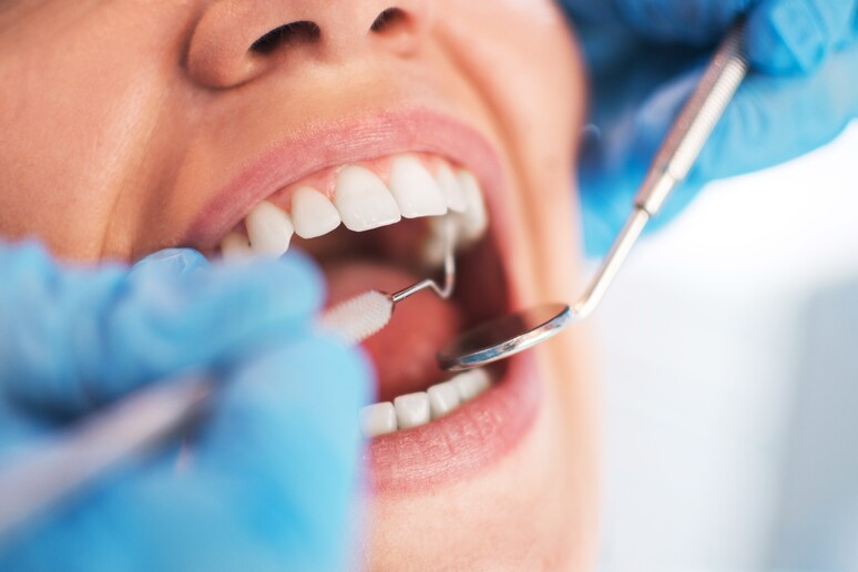 In Italia 15 mila dentisti abusivi, al Nord oltre la metà - RIPRODUZIONE RISERVATA