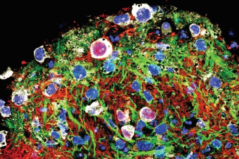 Immagine al microscopio di un cicuitoide formato da cellule nervose coltivate dalle staminali (fonte: Salk Institute) - RIPRODUZIONE RISERVATA