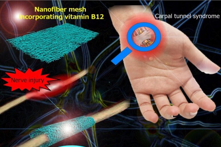 Rappresentazione di una rete di nanofili che avvolge un lervo lesionato (fonte: National Institute for Materials Science (NIMS)) - RIPRODUZIONE RISERVATA