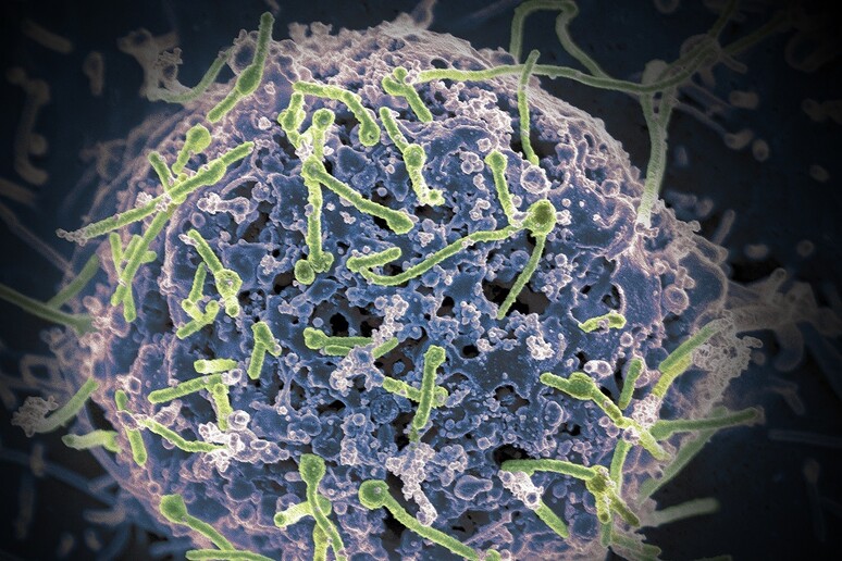 Le mappe genetiche del virus Ebola svelano le dinamiche dell 'epidemia (fonte: NIAID) - RIPRODUZIONE RISERVATA