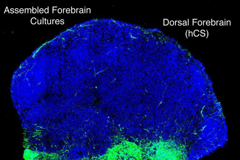 Mini cervelli umani ricreati in 3D mostrano  'in diretta ' lo sviluppo delle connessioni nervose del feto (fonte: Pasca Lab at Stanford University) - RIPRODUZIONE RISERVATA