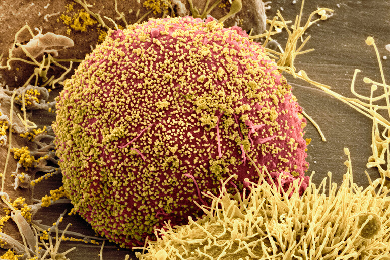 Una particella del virus Hiv vista al microscopio (fonte: Thomas Deerinck, NCMIR/SPL) - RIPRODUZIONE RISERVATA