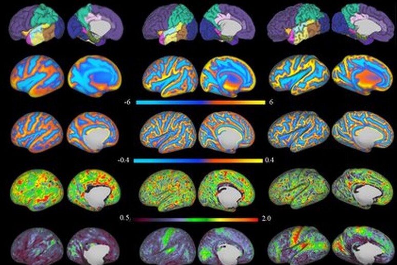Immagini tratte dalla mappa del cervello umano (fonte: Developing Human Connectome Project) - RIPRODUZIONE RISERVATA