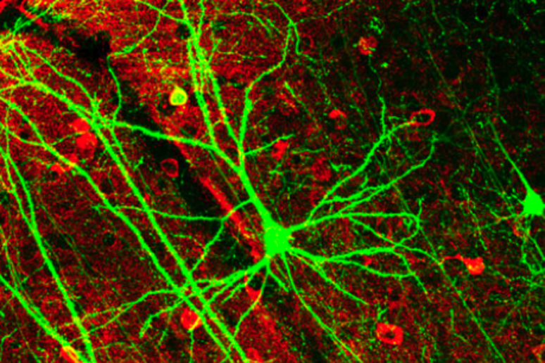 Le cellule della corteccia cerebrale (fonte: Nrets) - RIPRODUZIONE RISERVATA