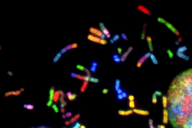 Cromosomi del più aggressivo tumore del cervello, il glioblastoma (fonte: NIH Image Gallery) - RIPRODUZIONE RISERVATA