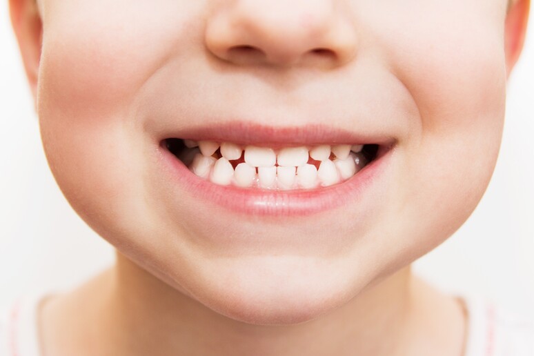 Digrignare i denti è uno dei sintomi nelle vittime di bullismo - RIPRODUZIONE RISERVATA