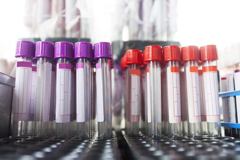 Entro il 2018 disponibile un test del sangue per individuare il tumore al polmone - RIPRODUZIONE RISERVATA