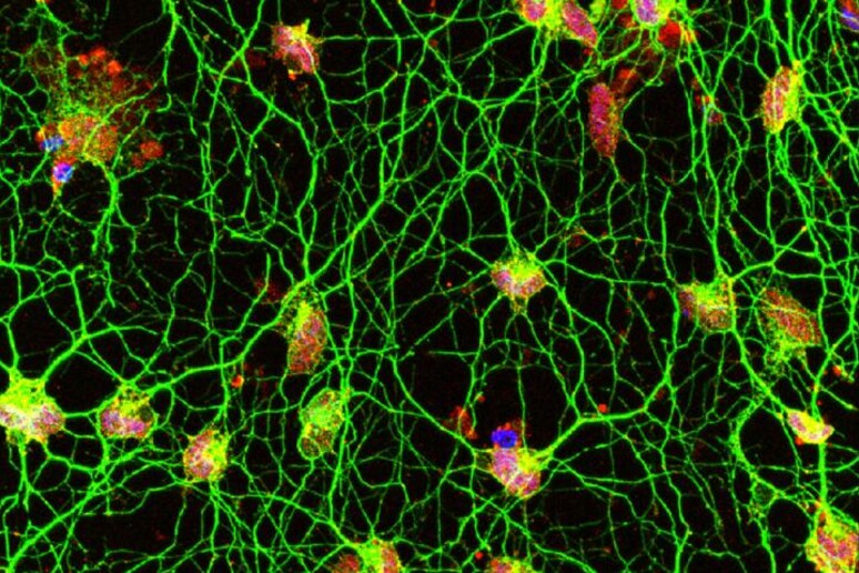 Le cellule della pelle trasformate in neuroni del movimento (fonte: Daniel Abernathy) - RIPRODUZIONE RISERVATA