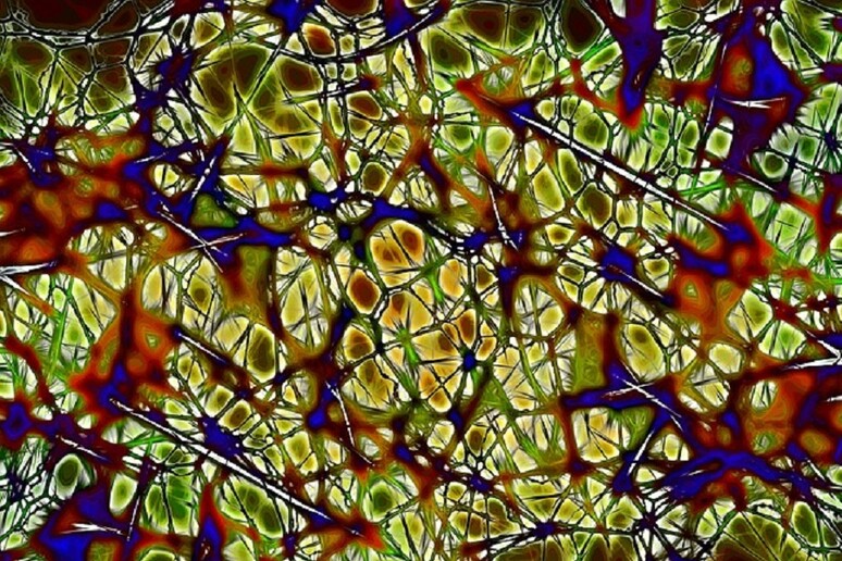 Bloccata nelle cellule la cascata di eventi che scatena il morbo di Parkinson (fonte: Max Pixel) - RIPRODUZIONE RISERVATA