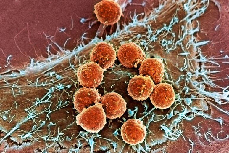 Cellule del sistema immunitario (in arancione) aggrediscono cellule tumorali (fonte: Memorial Sloan Kettering Cancer Center) - RIPRODUZIONE RISERVATA
