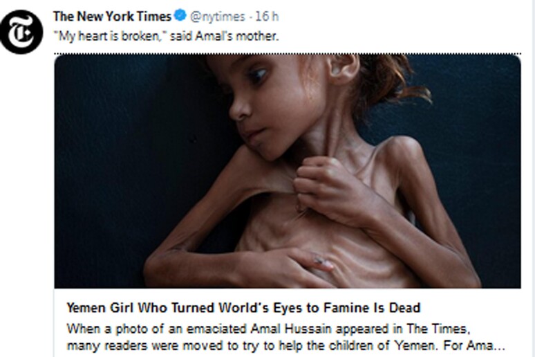 Yemen: morta Amal, bimba simbolo sofferenze della guerra - RIPRODUZIONE RISERVATA
