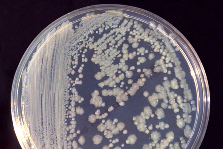 Una coltura di Enterobacter cloacae (fonte: CDC -PHIL #6552- 1983) - RIPRODUZIONE RISERVATA