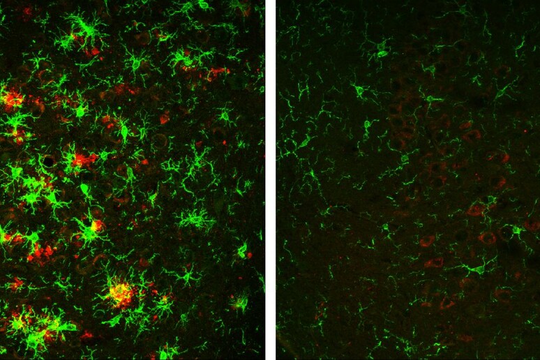 A sinistra il tessuto del cervello di un topo con l 'Alzheimer pieno di placche amiloidi (in rosso); a destra le placche sono quasi scomparse in un topo che ha perso gradualmente l 'enzima Bace1 (fonte: Hu et al., 2018) - RIPRODUZIONE RISERVATA