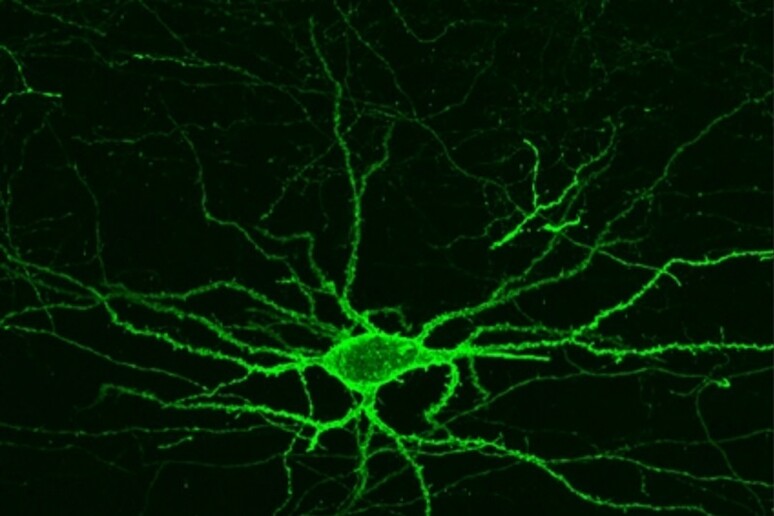 Neuroni resi fluorescenti da una proteina sensibile alla loro attività elettrica (fonte: MIT) - RIPRODUZIONE RISERVATA