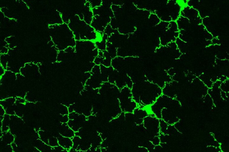 In verde cellule immunitarie, dette microglia, nella retina di un topo adulto in salute (fonte: Wai T. Wong, National Eye Institute) - RIPRODUZIONE RISERVATA