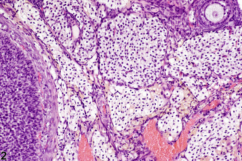 Cellule del tessuto interstiziale (fonte: National Toxicologic Program) - RIPRODUZIONE RISERVATA