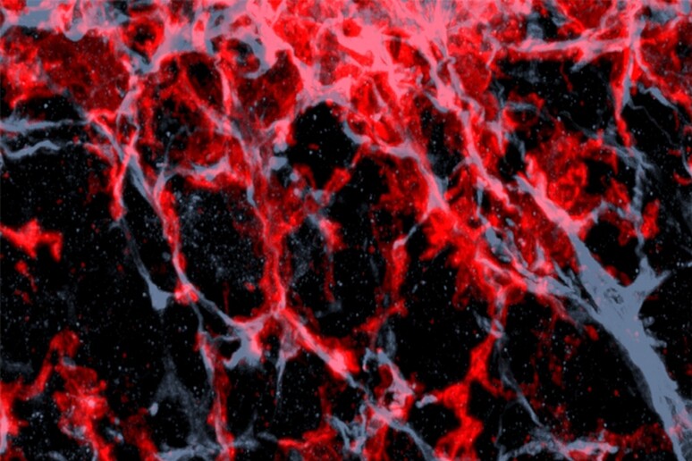 Tessuto tumorale di topo nel quale sono evidenziati i macrofaci, le cellule del sistema immunitario che vengono indotte ad aiutare la crescita dei tumori (fonte: Tim Lämmermann, Max Planck Institute of Biochemistry) - RIPRODUZIONE RISERVATA