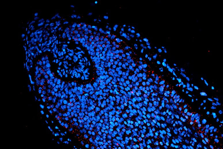 Follicolo di un capello umano:  in blu i nuclei delle cellule che compongono la base vitale del capello, in rosso indicano le vescicole dell’autofagia (fonte: IIT) - RIPRODUZIONE RISERVATA