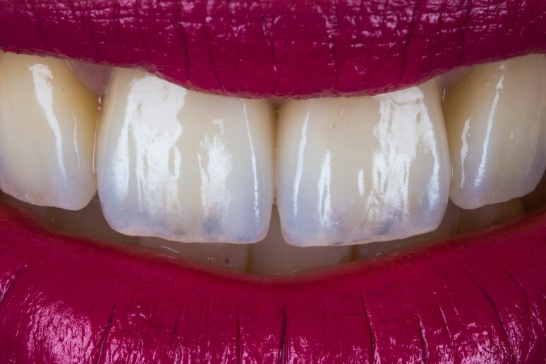I denti in futuro si ricostruiranno con un gel - RIPRODUZIONE RISERVATA