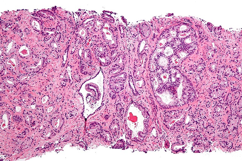 Tessuto del umore della prostata (fonte: Nephron) - RIPRODUZIONE RISERVATA
