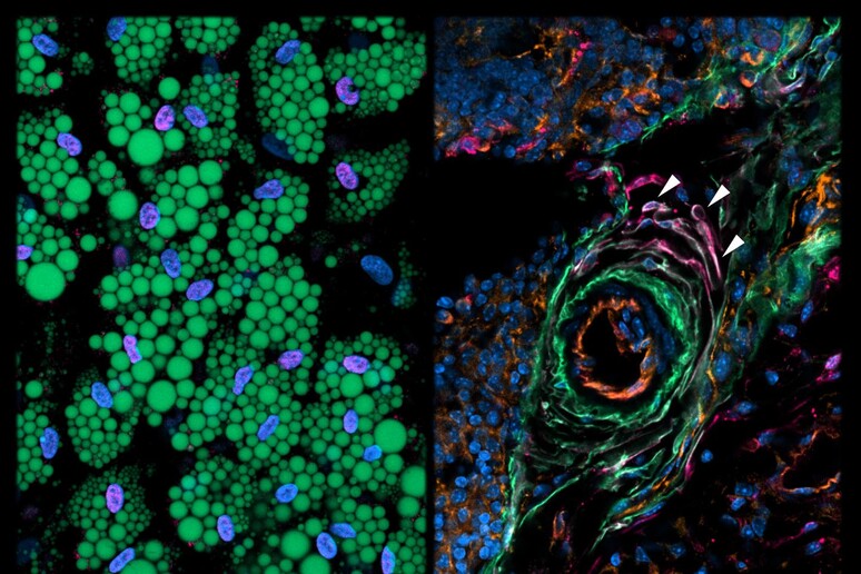 A sinistra le cellule del grasso umane, a destra quelle dei topi (fonte: Bart Deplancke/EPFL) - RIPRODUZIONE RISERVATA