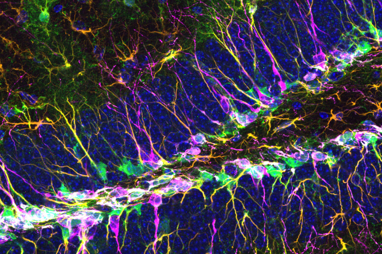 Scoperto il gene che regola le cellule staminali del cervello (fonte: S. Bonzano et al., Cell Reports) - RIPRODUZIONE RISERVATA