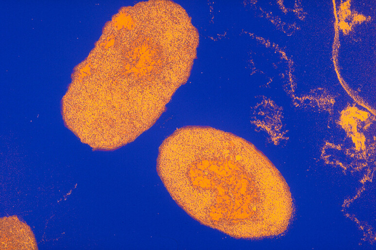 Il batterio della pertosse, il Bordetella pertussis (fonte: Sanofi Pasteur, Flickr) - RIPRODUZIONE RISERVATA