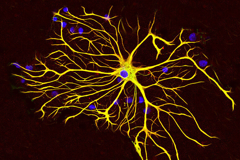 Una cellula nervosa (fonte: GerryShaw) - RIPRODUZIONE RISERVATA