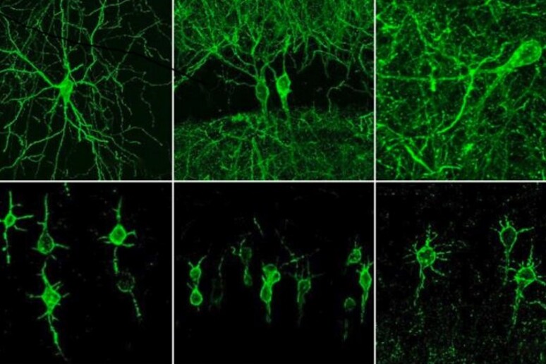 Le prime foto dei neuroni in attività, ottenute grazie a una molecola fluorescente. In basso, in evidenza solo i corpi centrali delle cellule (fonte: Ed Boyden/MIT) - RIPRODUZIONE RISERVATA