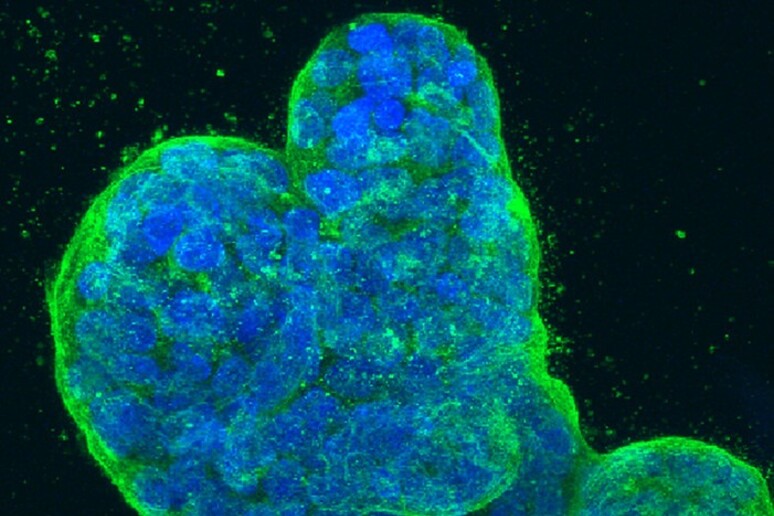 Cellule umane di tumore della mammella coltivate in 3D (fonte: NCI Center for Cancer Research, National Cancer Institute, National Institutes of Health) - RIPRODUZIONE RISERVATA
