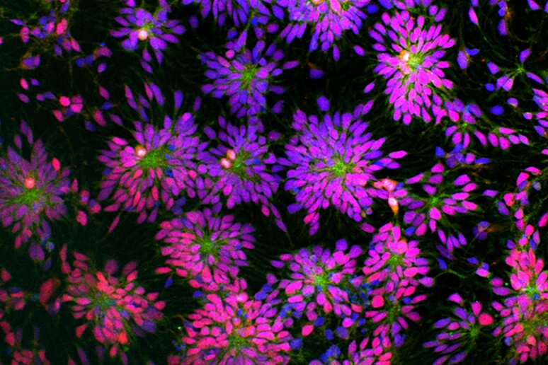 Cellule staminali umane riprogrammate a partire da neuroni (fonte: Yichen Shi e Rick Livesey, Gurdon Institute, University of Cambridge) - RIPRODUZIONE RISERVATA