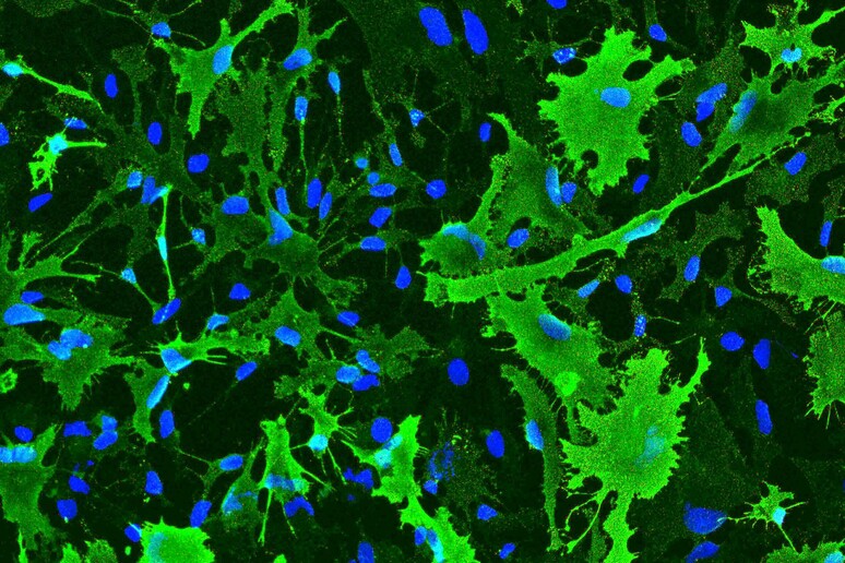 Cellule staminali cerebrali  (fonte: Laboratorio Cellule Staminali, Cell Factory e Biobanca dell 'azienda ospedaliera Santa Maria di Terni) - RIPRODUZIONE RISERVATA