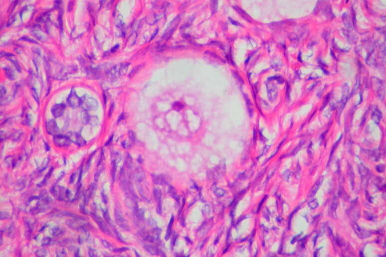 Ovocita e tessuto ovarico (fonte: Ed Uthman from Houston, TX, USA, da Wikipedia) - RIPRODUZIONE RISERVATA