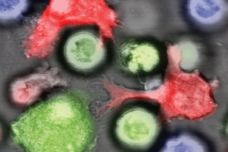 Cellule immunutarie (in rosso) aggrediscono le cellule tumorali (in verde). In blu le cellule staminali dei tumori (fonte: Schürch/Lengerke, University Hospital of Basel) - RIPRODUZIONE RISERVATA