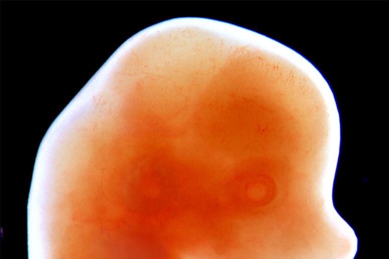 Particolare dell 'embrione di un topo a 13 giorni (fonte: Craig Rhodes e Kenneth Yamada, National Institute of Dental and Craniofacial Research, National Institutes of Health) - RIPRODUZIONE RISERVATA
