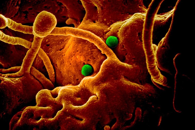In verde particelle del coronavirus responsabile della Mers su cellule di cammello (fonte: NIAID, Colorado State University) - RIPRODUZIONE RISERVATA
