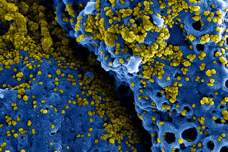 Particelle di coronavirus viste al microscopio elettronico (fonte: NIAID, Flickr) - RIPRODUZIONE RISERVATA