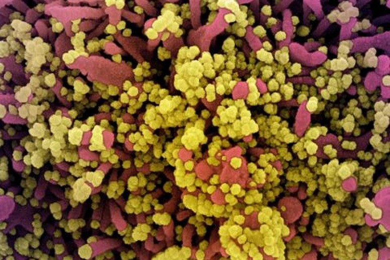 Particelle del virus SarsCoV2 responsabili della pandemia di Covid-19 (fonte: NIAID) - RIPRODUZIONE RISERVATA